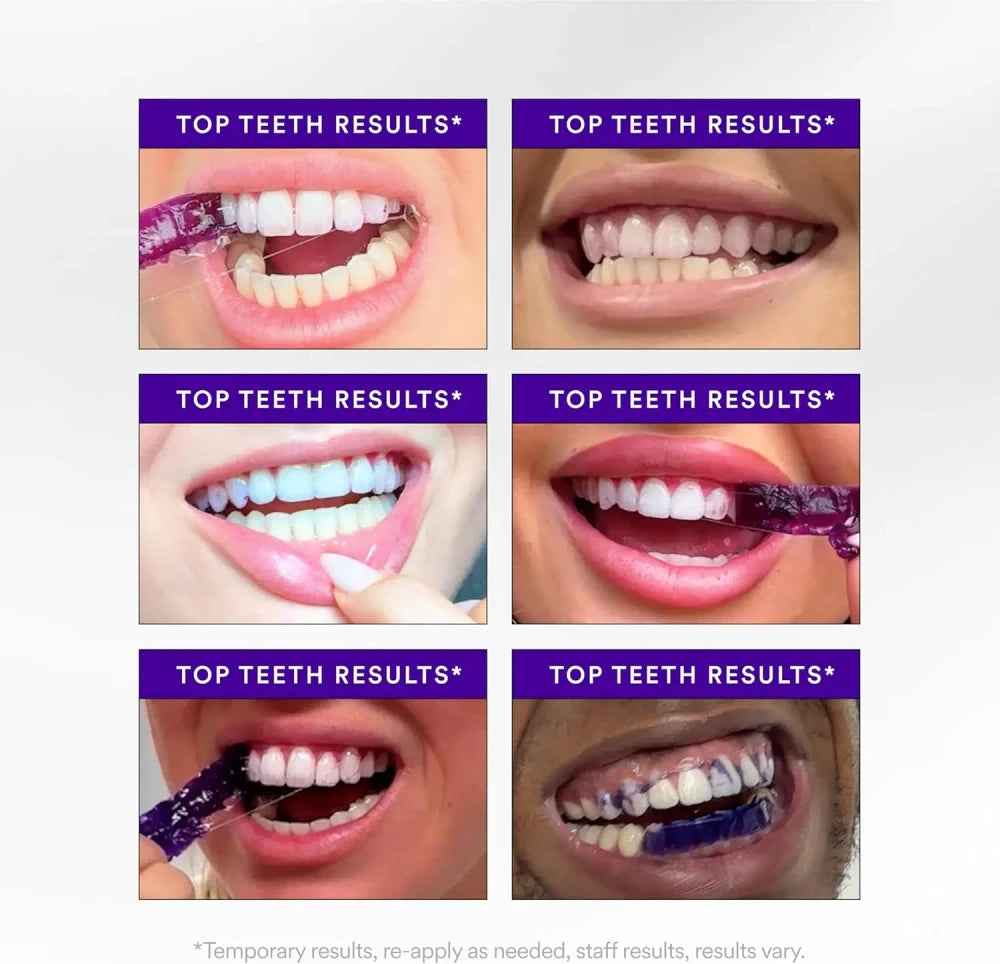 V34 Purple Whitening Strips